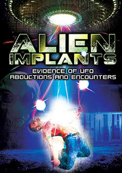 Alien Implants: Evidence Of Ufo Abductions & Encounters (DVD)